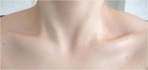 select-a-summer-stole-how-to-prevent-sunburn4